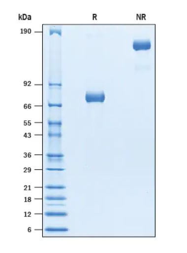 2 μg/lane Protein  was resolved with SDS-PAGE under reducing (R) and non-reducing (NR) conditions and visualized by Coomassie® Blue staining.